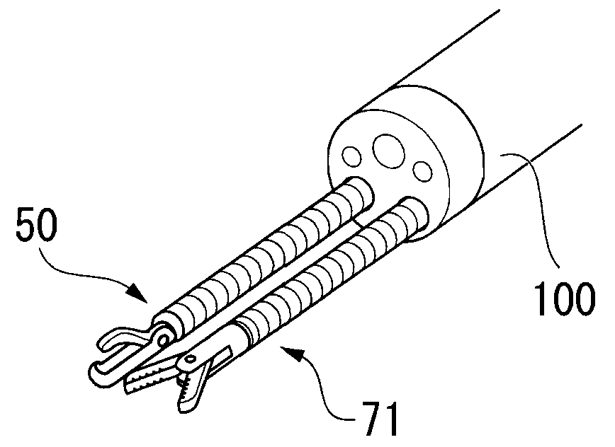 Medical treatment system and suturing method