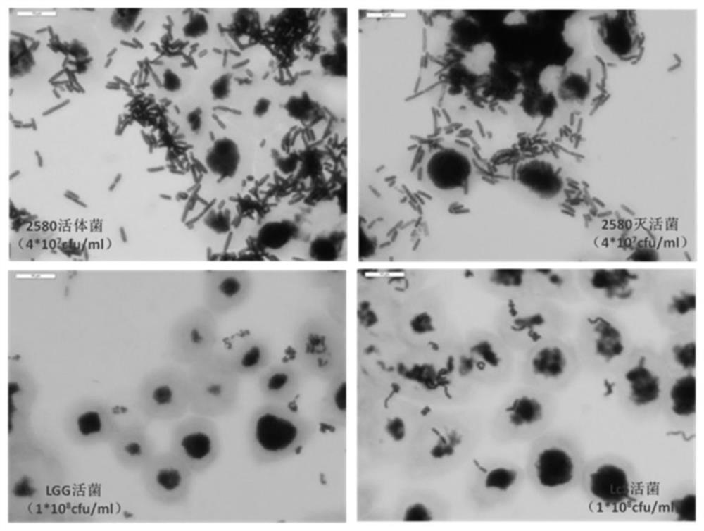 A strain of Lactobacillus helveticus with high adhesion performance and its application for enhancing immunity