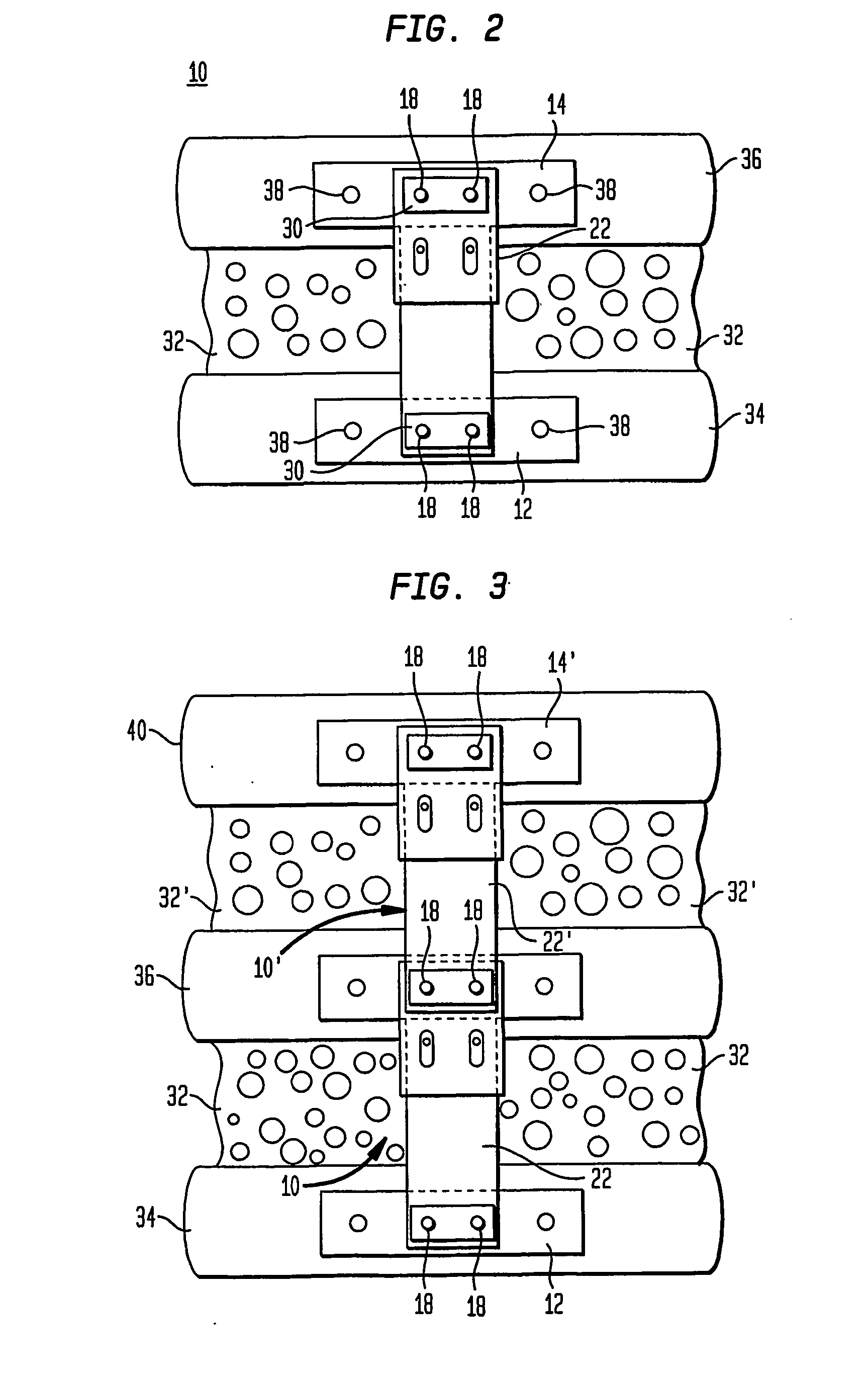 Mobile sleeve structure for maintaining spatial relationship between vertebrae