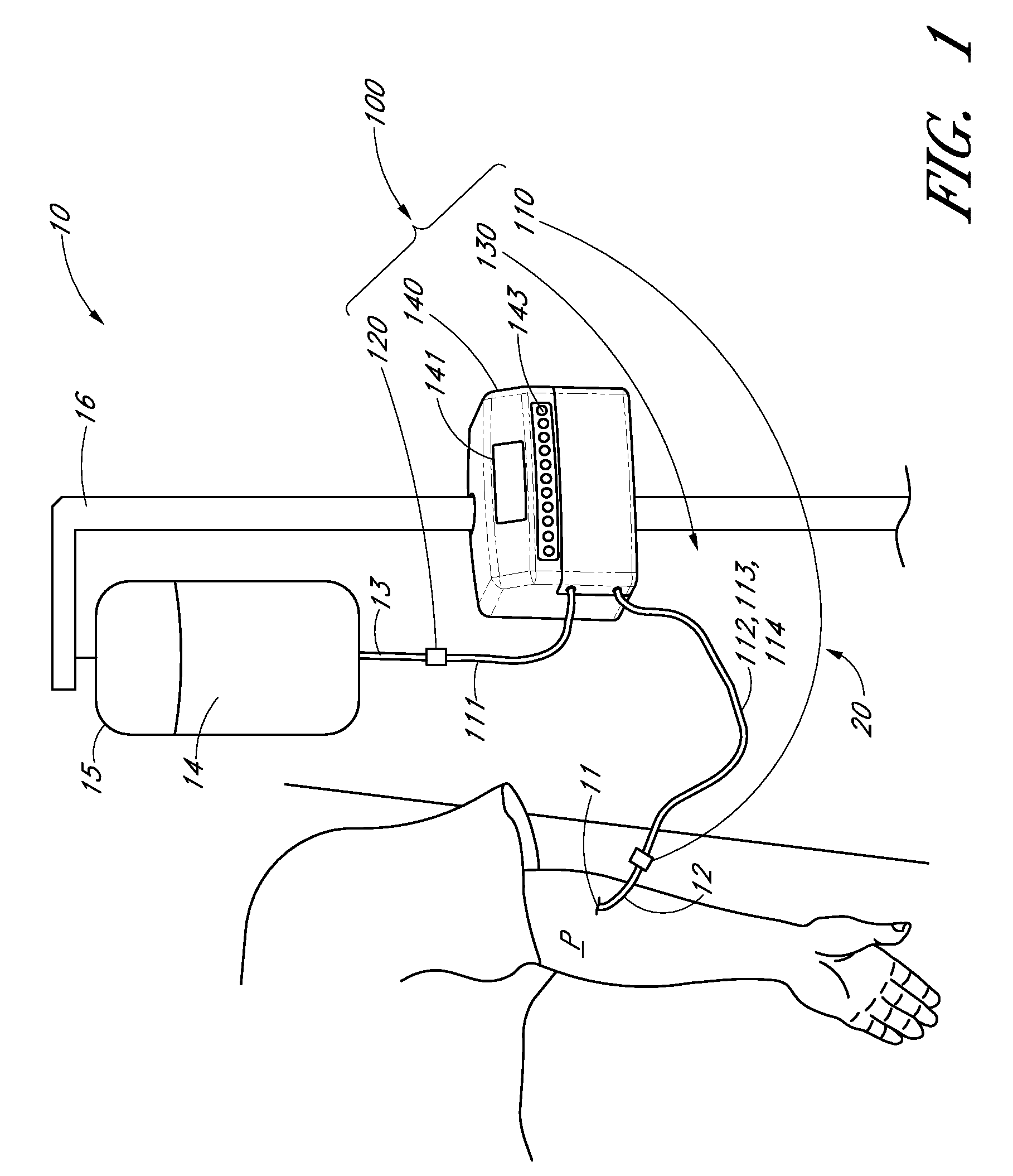Analyte detection system with periodic sample draw and body fluid analyzer