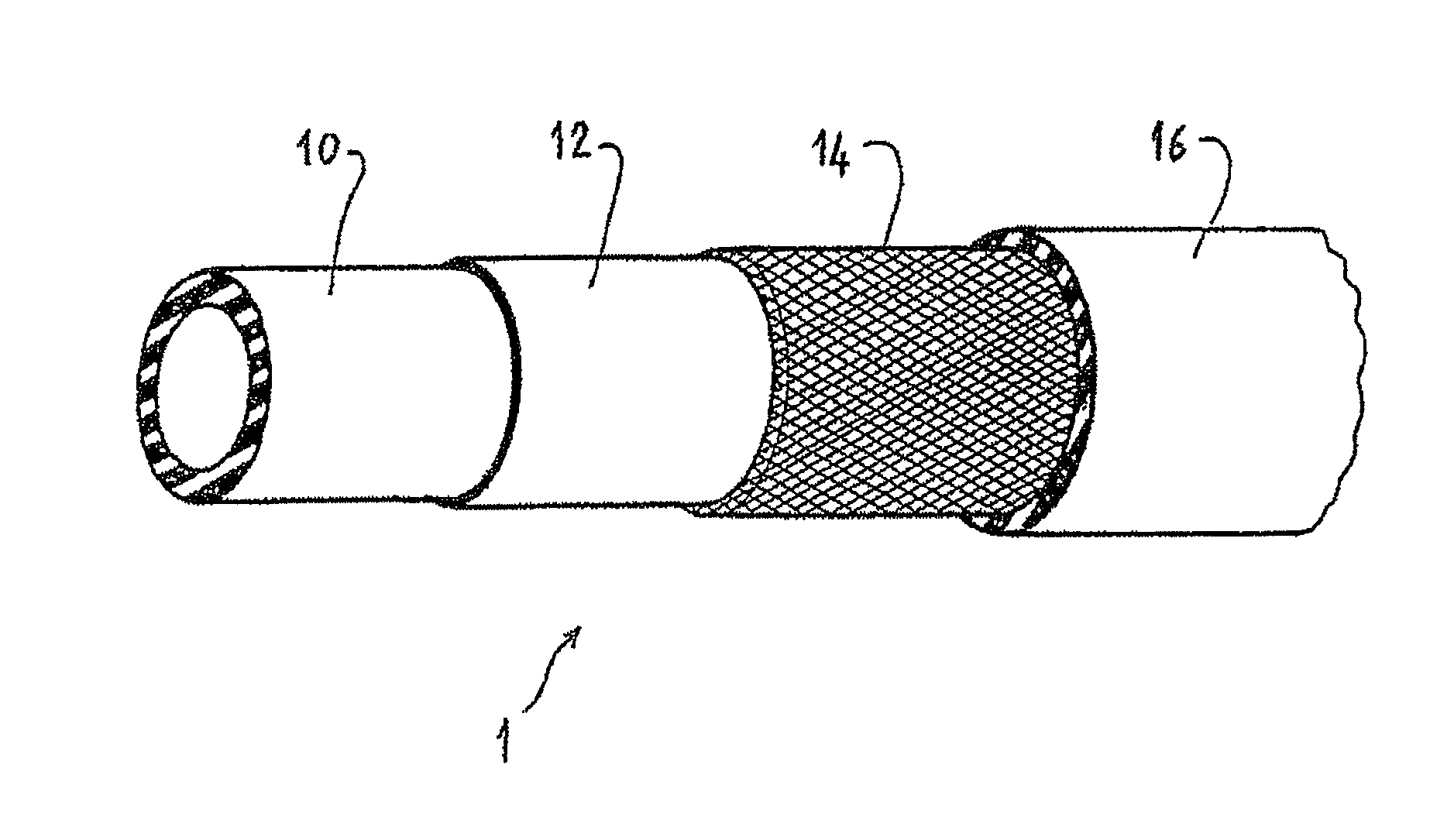 Pipe for the air intake circuit of a motor vehicle engine, and circuit incorporating the same