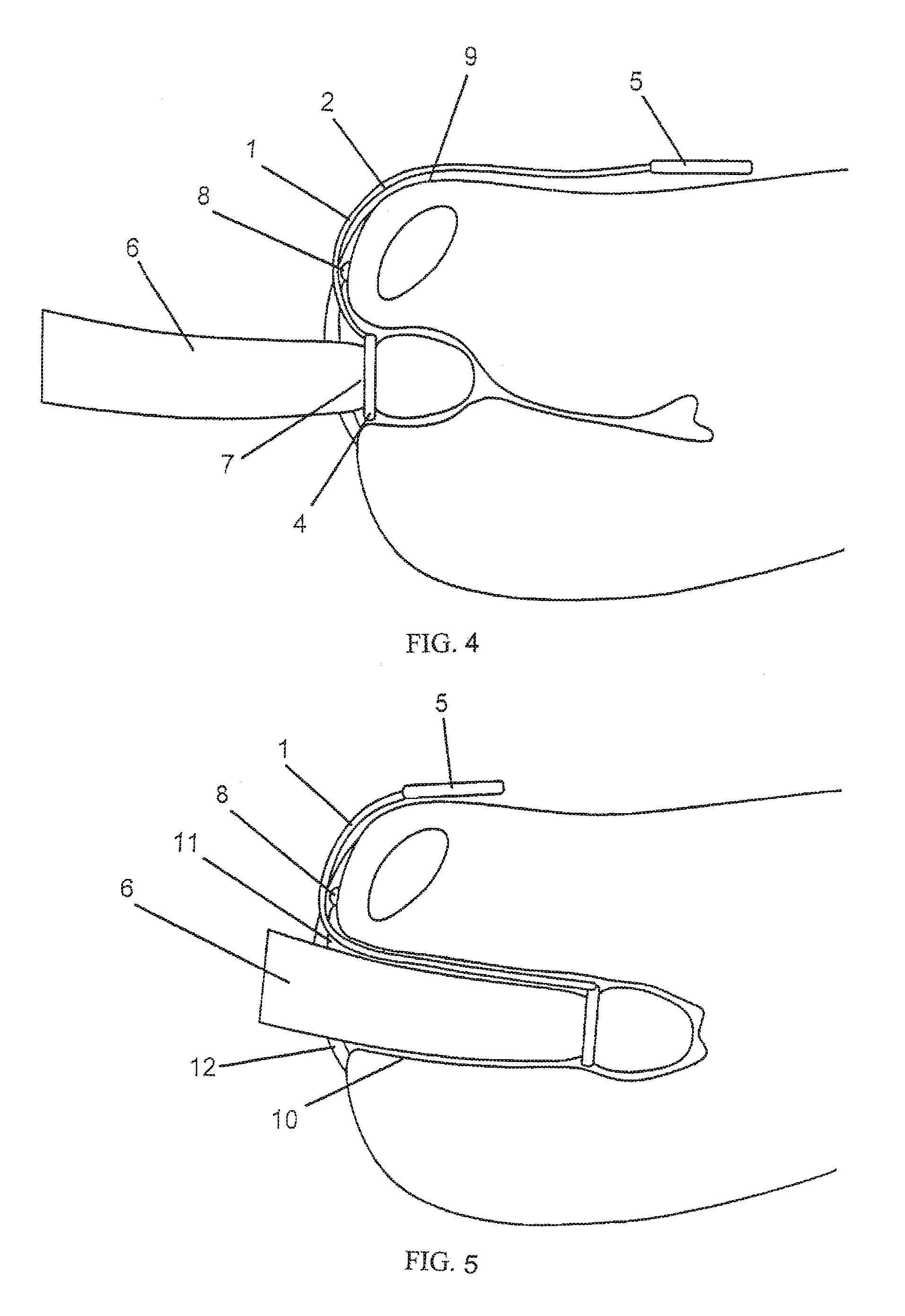 Clitoris friction stimulator and method for stimulating erogenic zones of a woman during a coition
