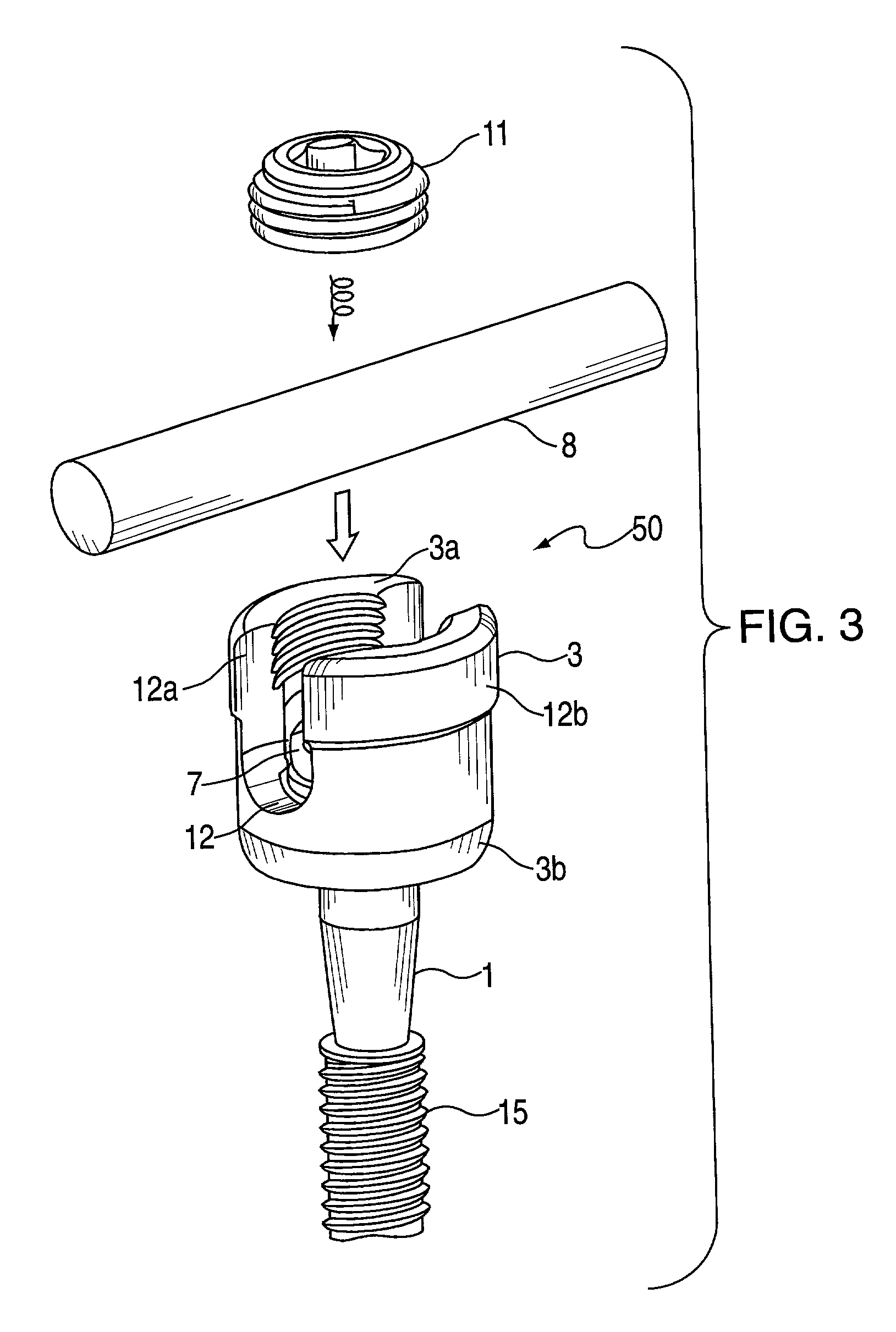 Surgical screw system and related methods