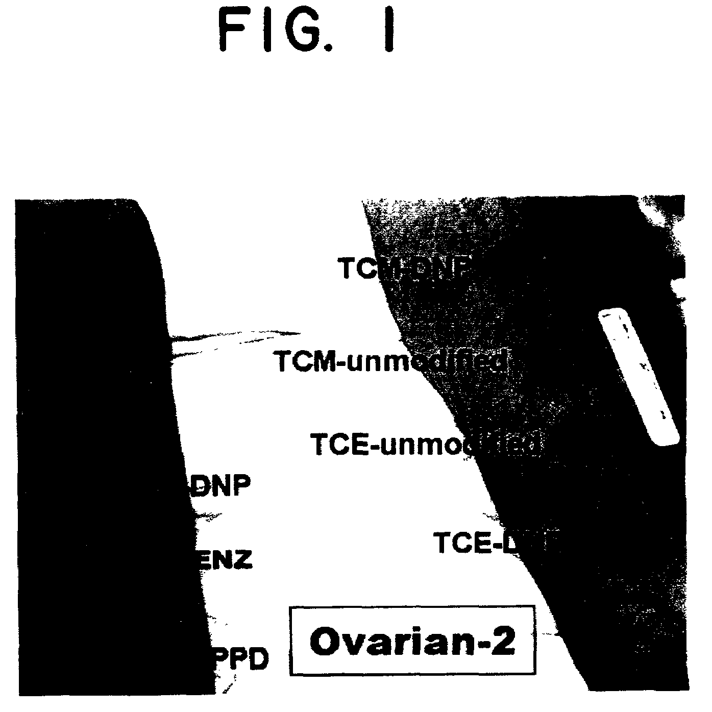 Composition and method of using carcinoma tumor cells