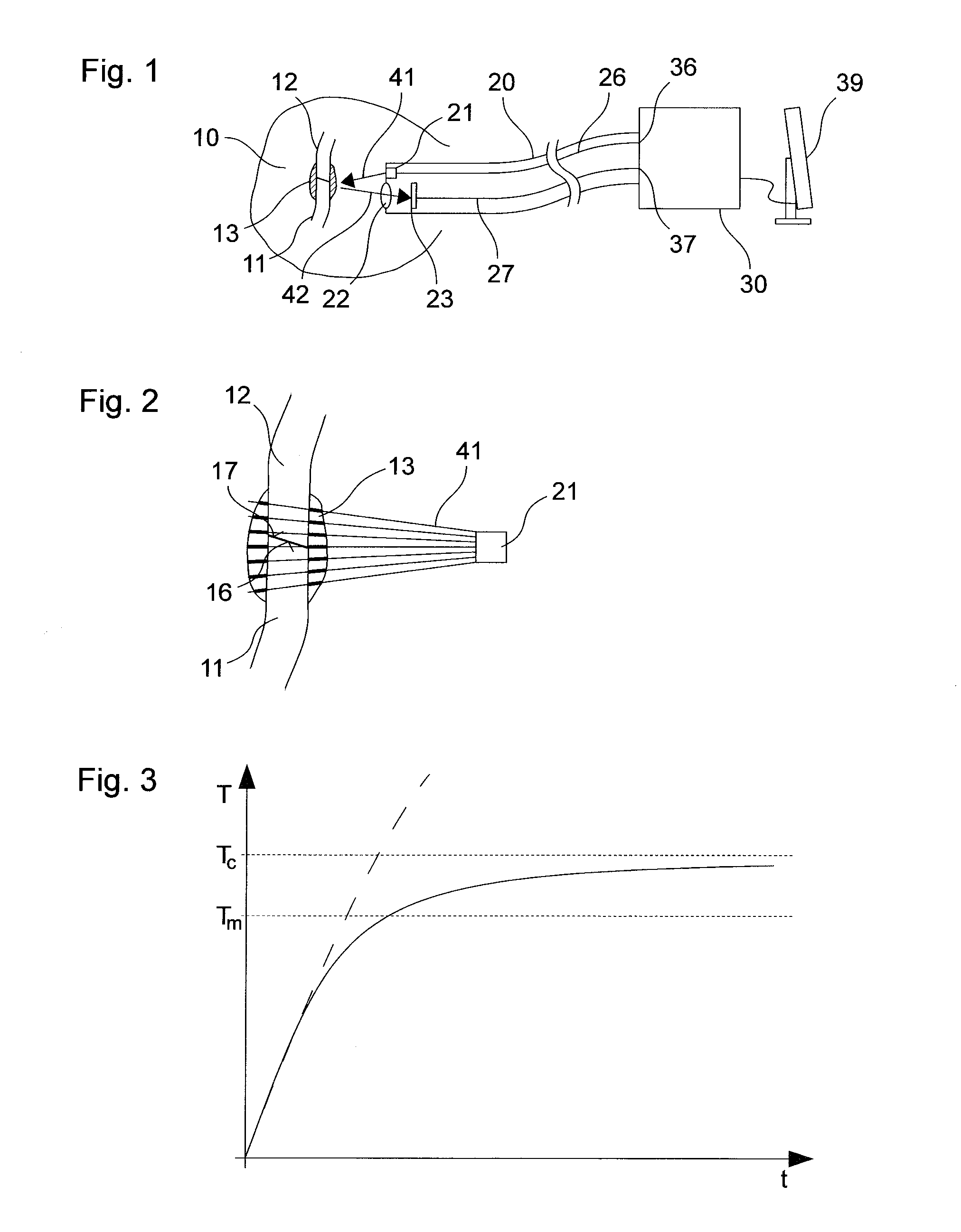 Method and solder for form-fitted joining of two surfaces
