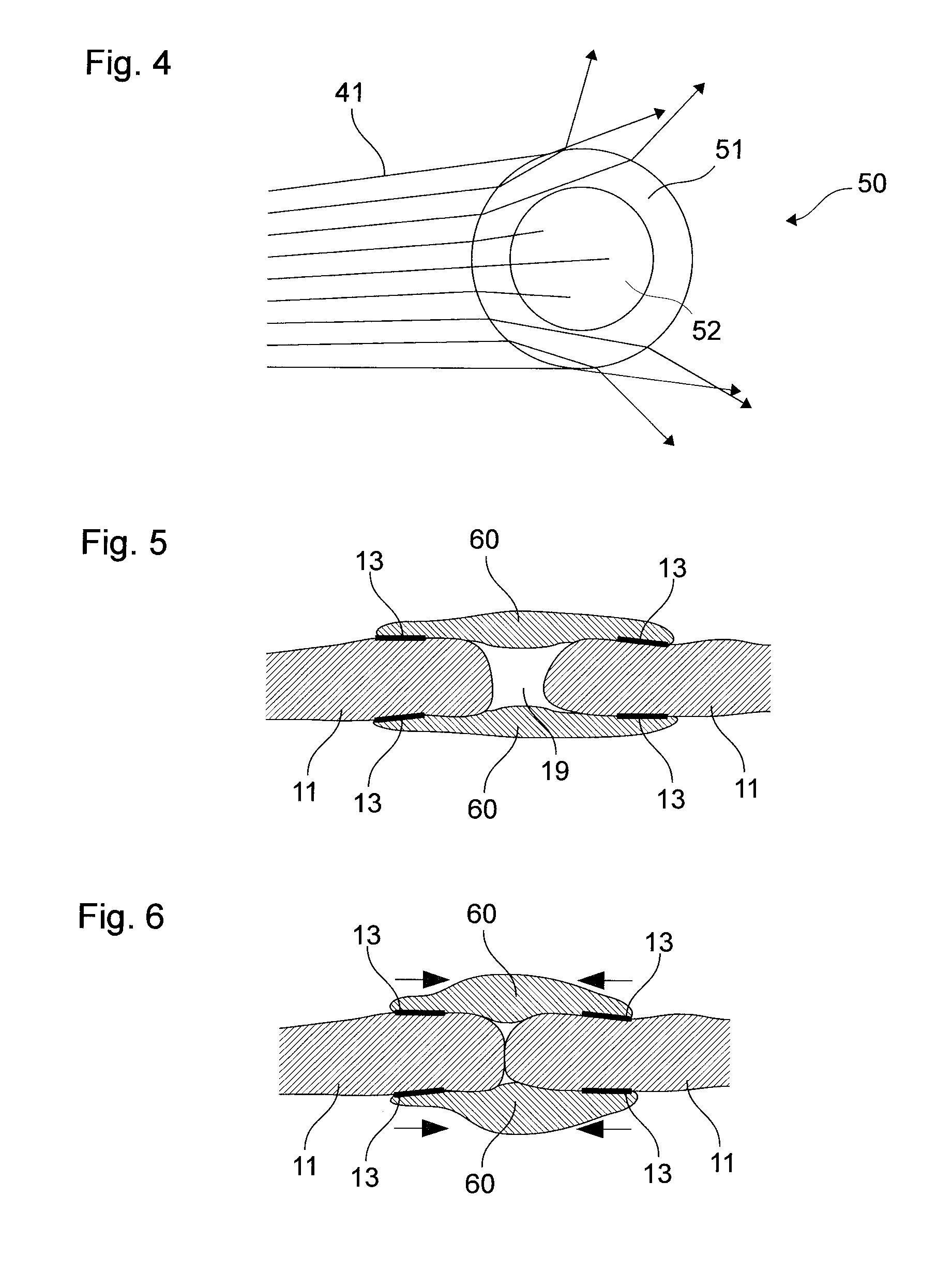 Method and solder for form-fitted joining of two surfaces