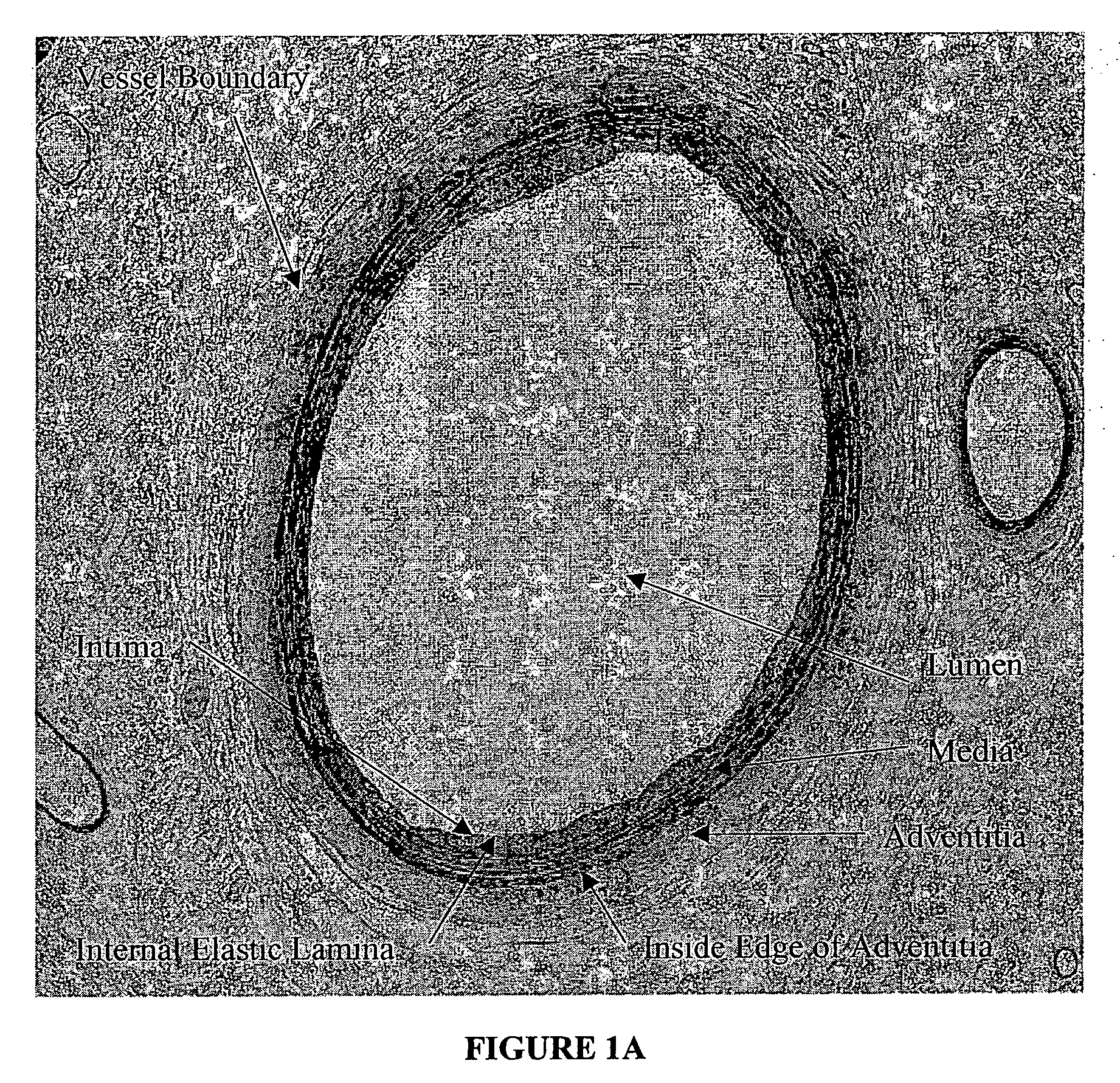 Method for quantitative analysis of blood vessel structure