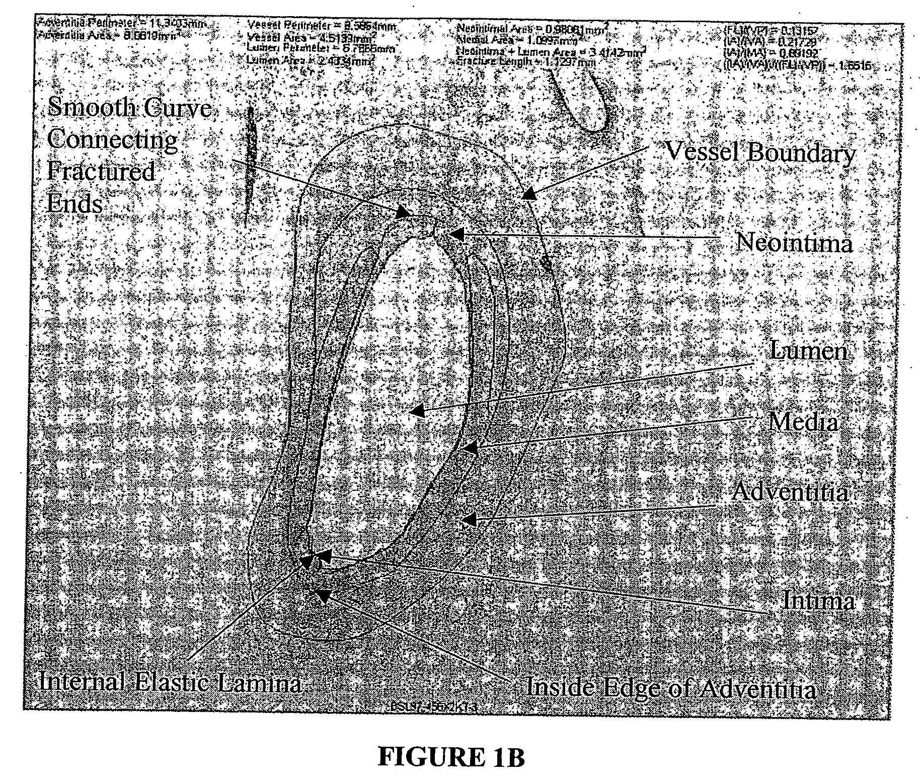 Method for quantitative analysis of blood vessel structure