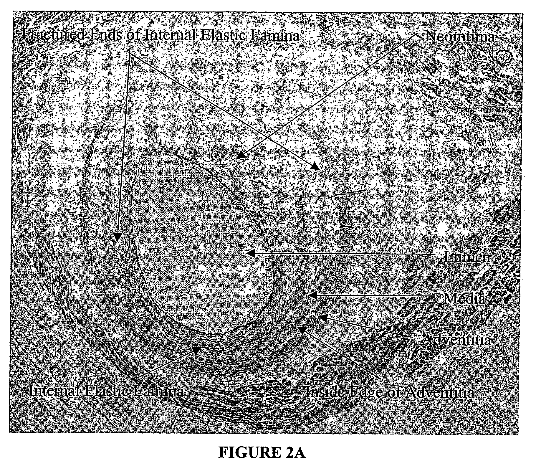 Method for quantitative analysis of blood vessel structure