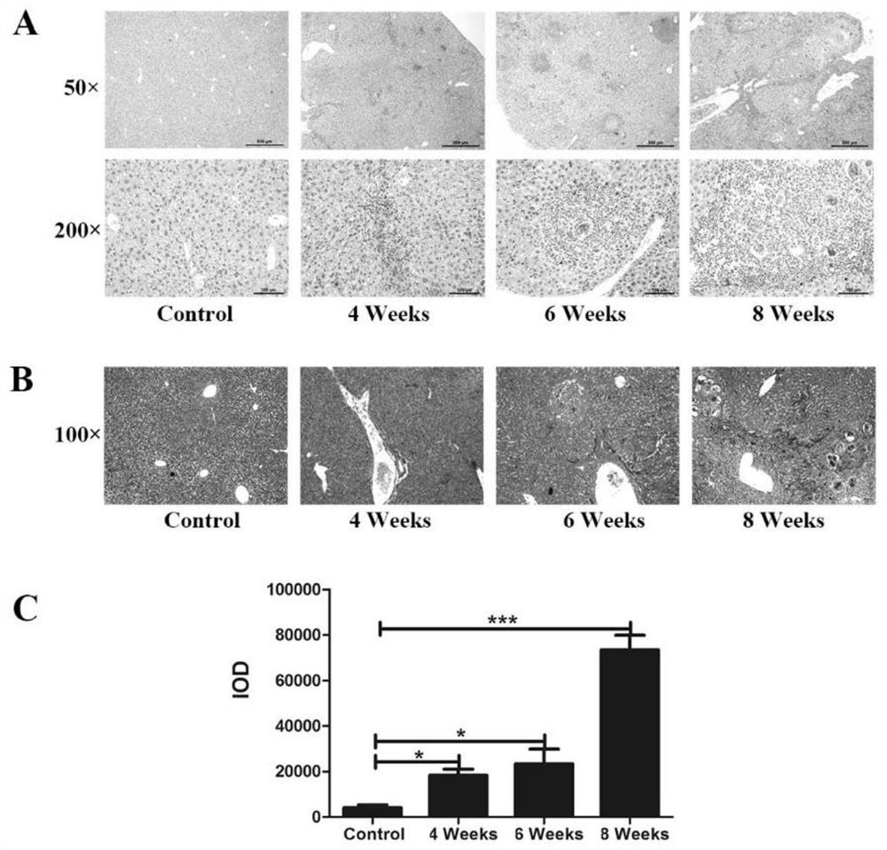 Application of β-actin protein as a serological diagnostic marker for hepatic fibrosis in schistosomiasis japonicum