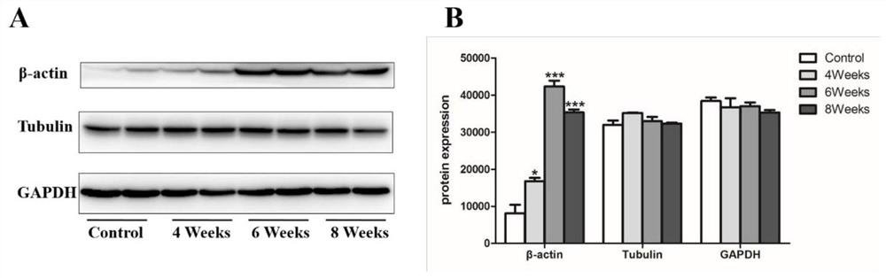 Application of β-actin protein as a serological diagnostic marker for hepatic fibrosis in schistosomiasis japonicum