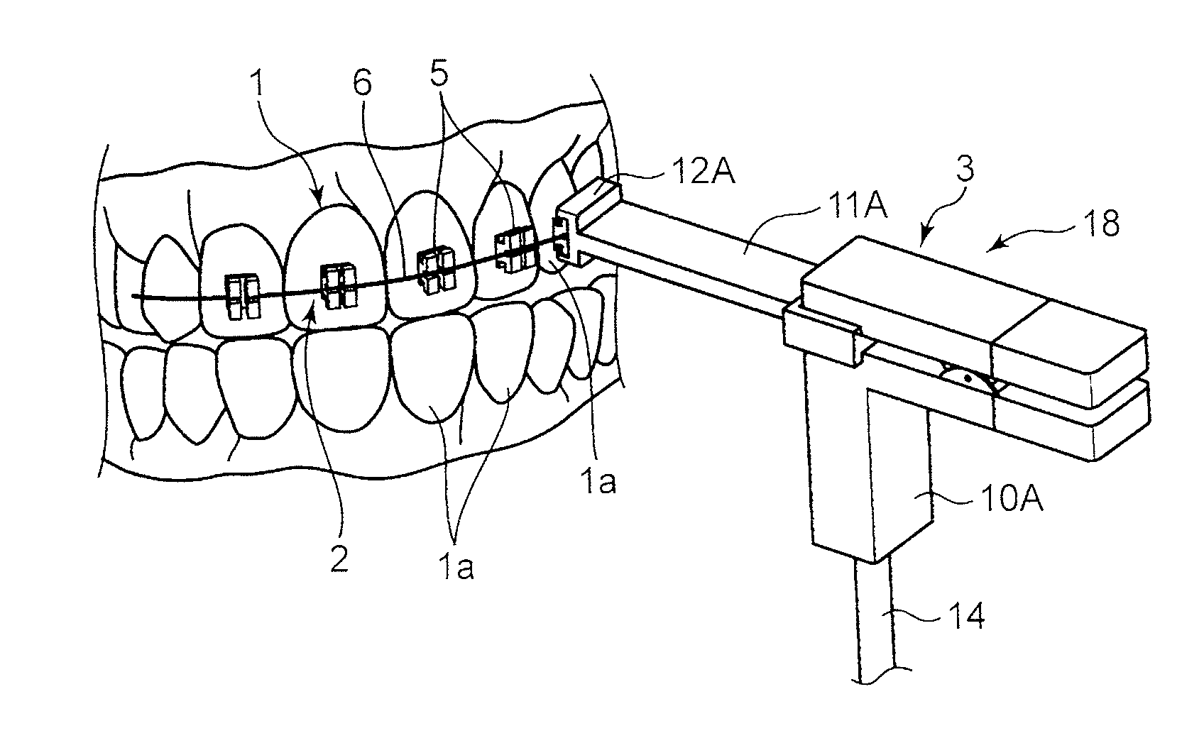 Vibration imparting device for dental use
