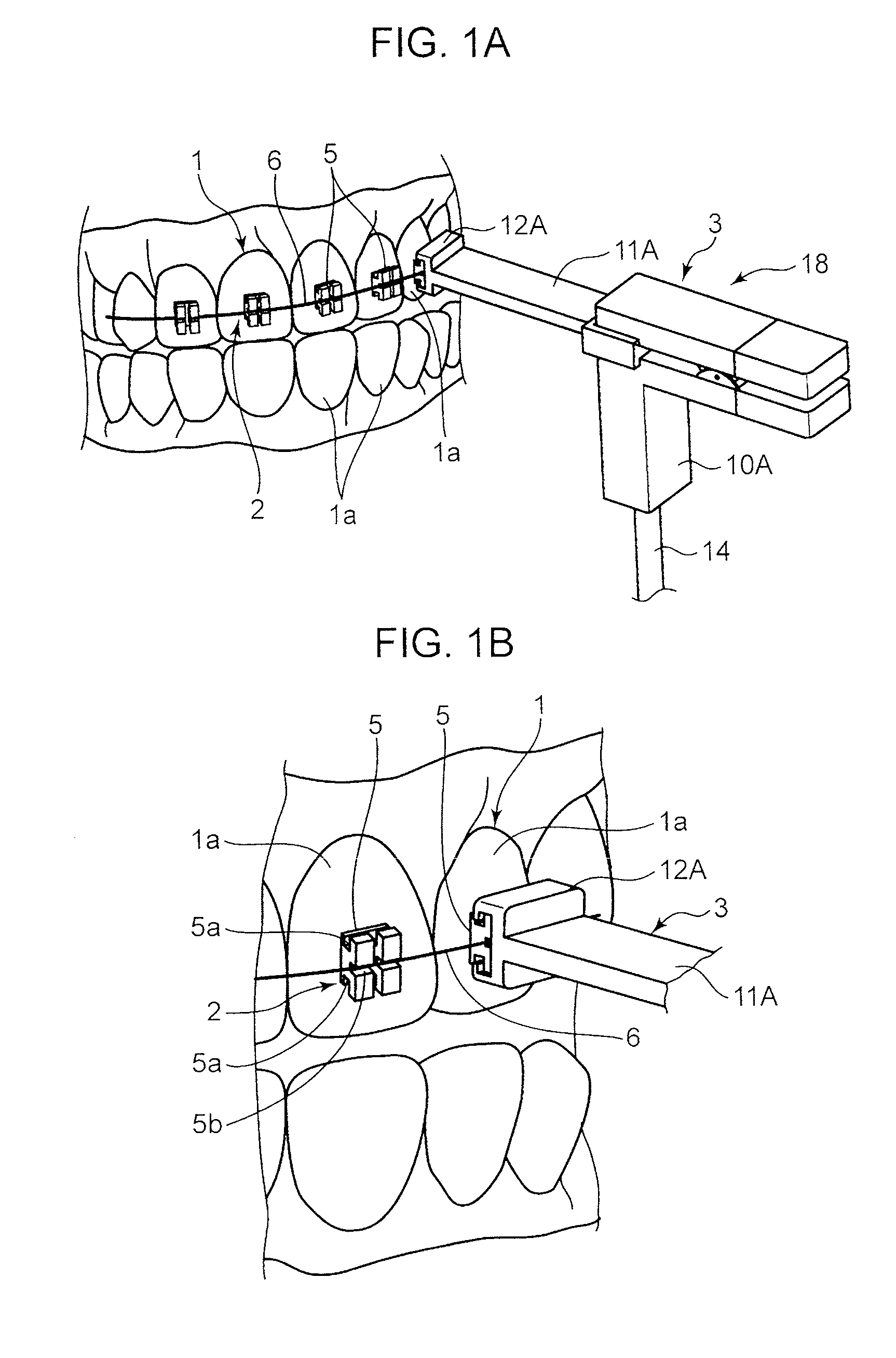 Vibration imparting device for dental use