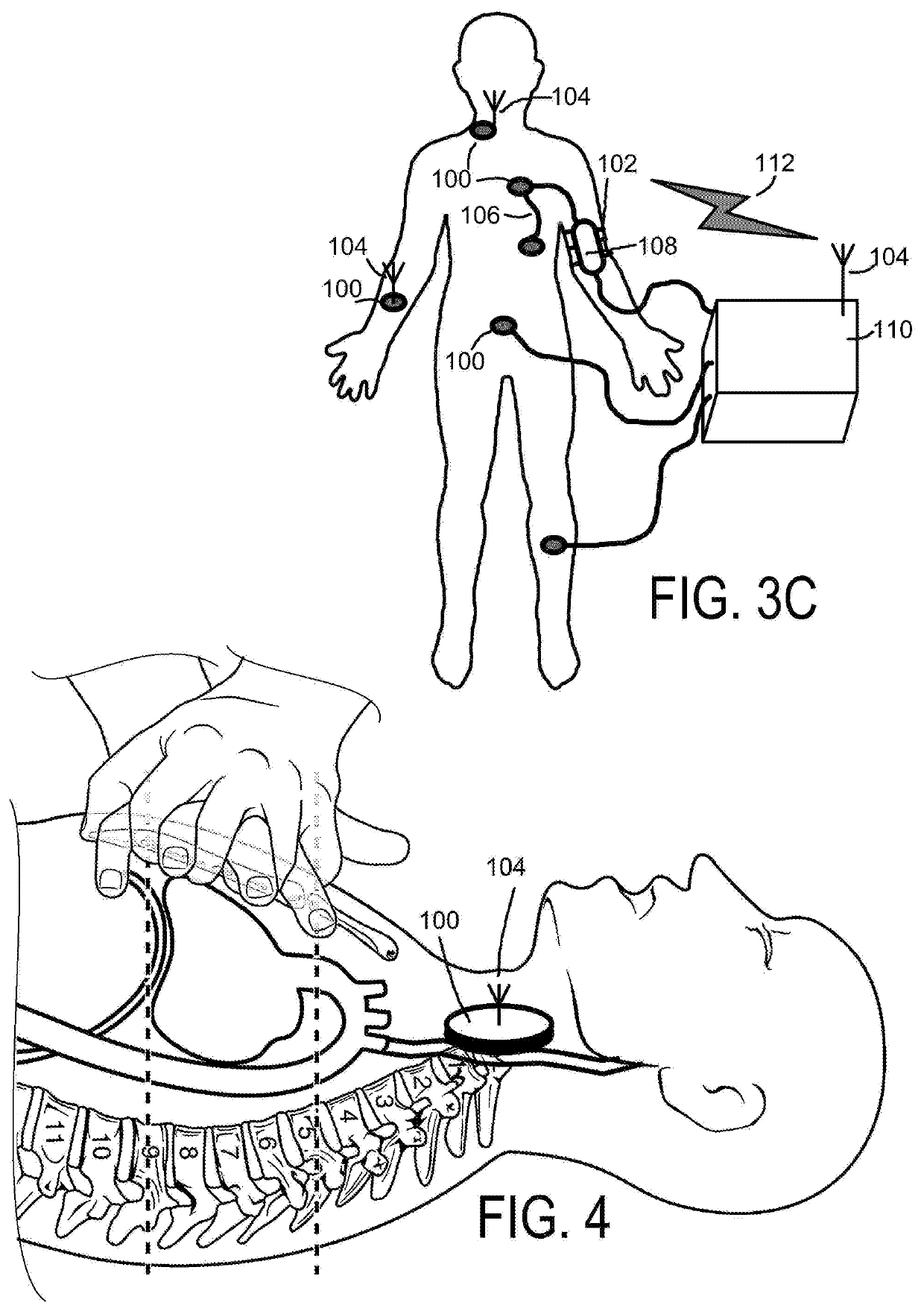 Diagnostic ultrasound monitoring system and method