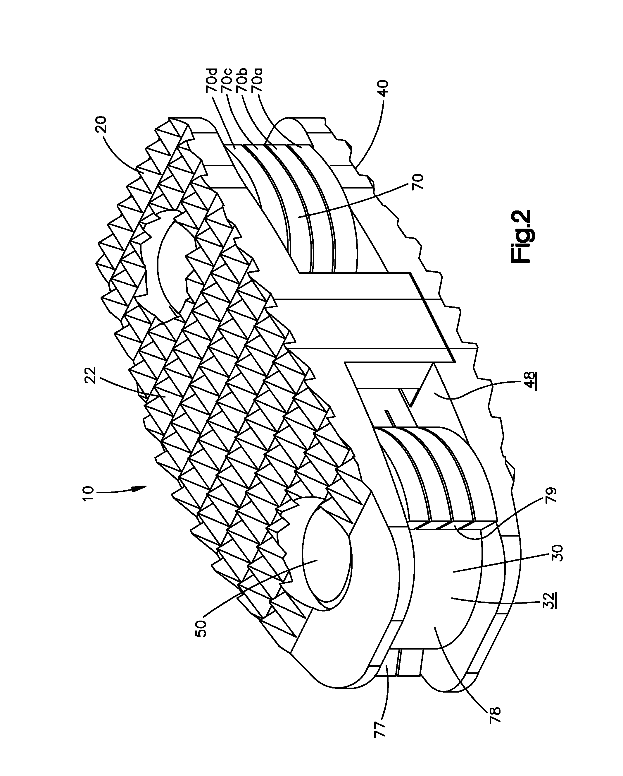 Expandable interbody spacer device