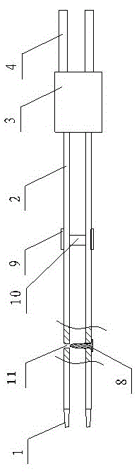 Intelligent type electric coagulation forcep system