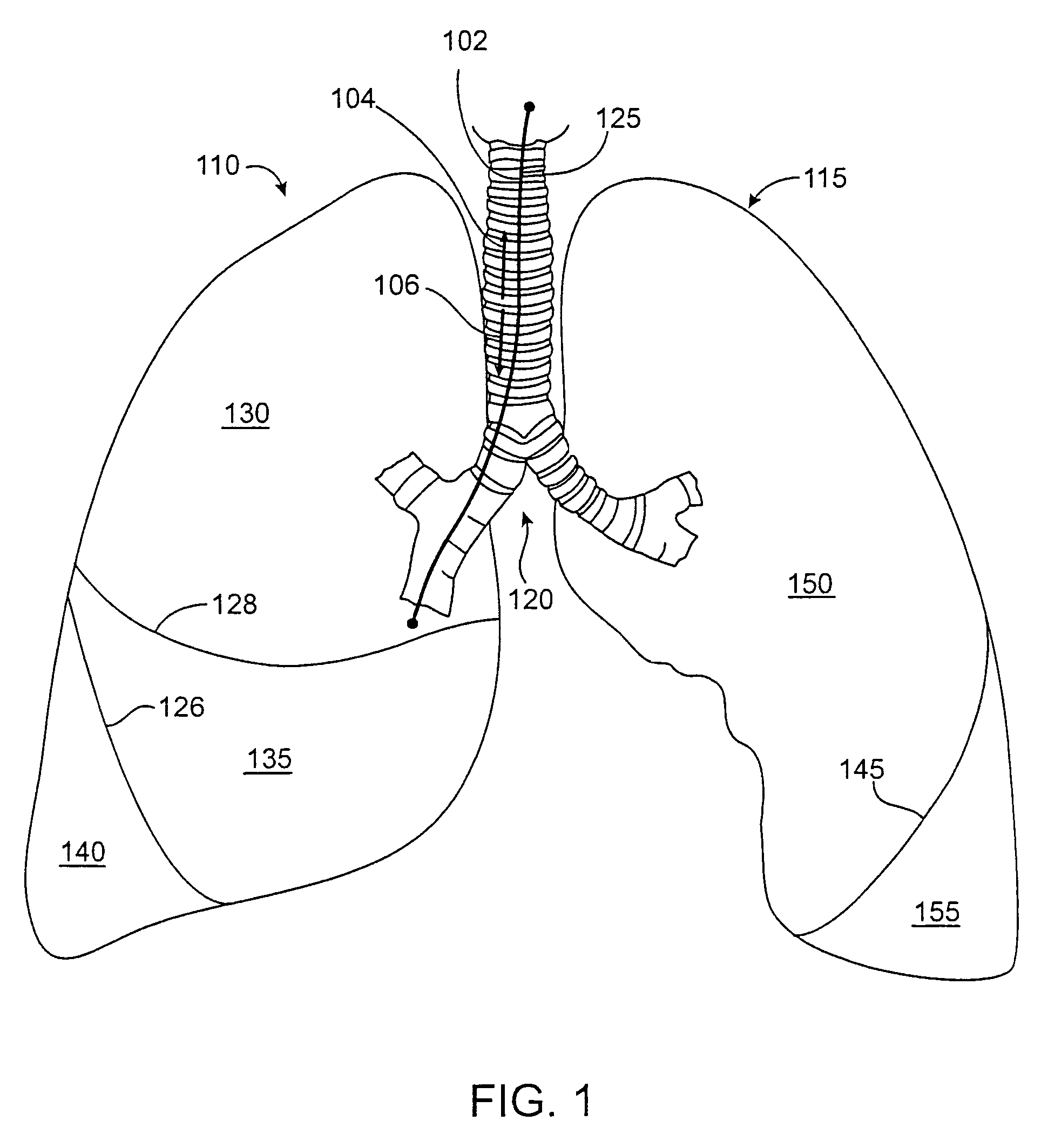 Methods and devices for inducing collapse in lung regions fed by collateral pathways