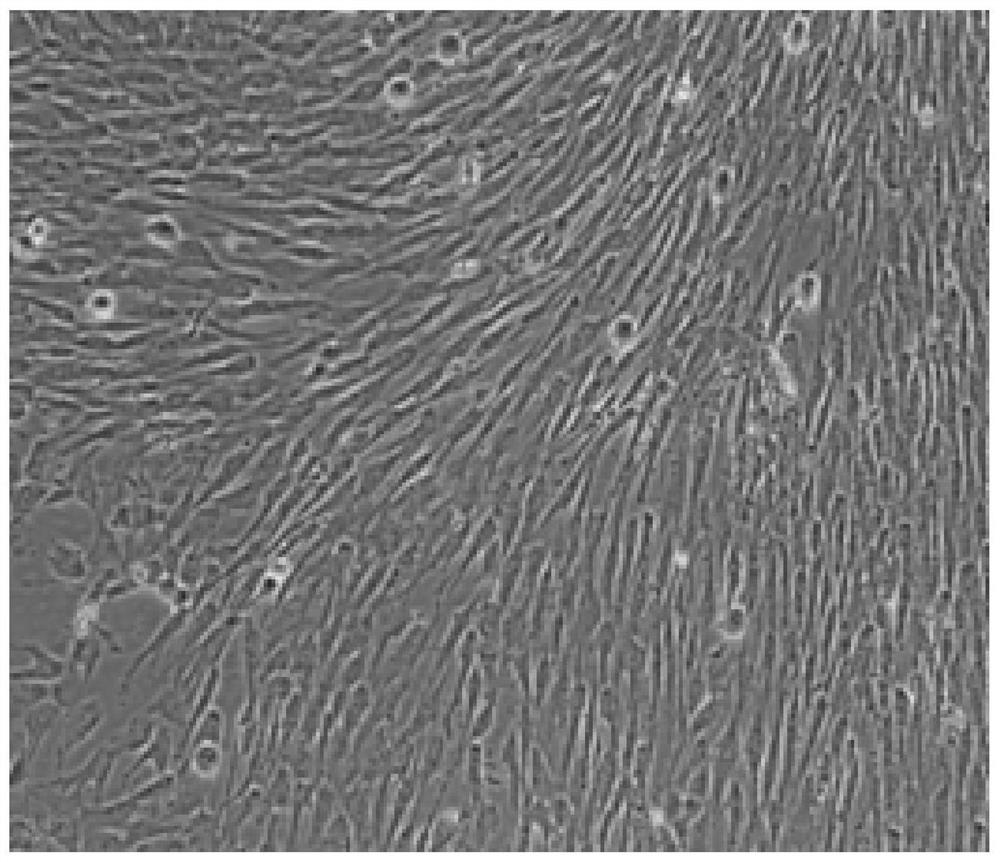 Method for preparing adipose tissue-derived stem cells by using serum-free culture medium