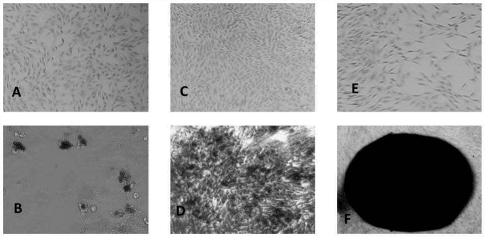 Method for preparing adipose tissue-derived stem cells by using serum-free culture medium