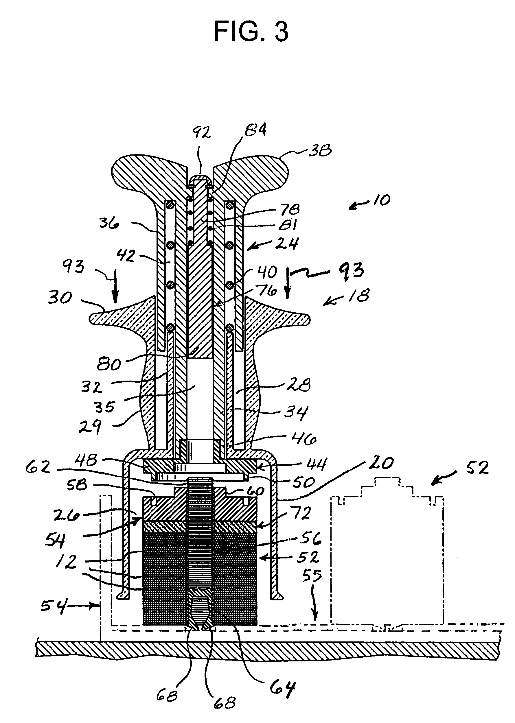 Reinforcing ring applicator