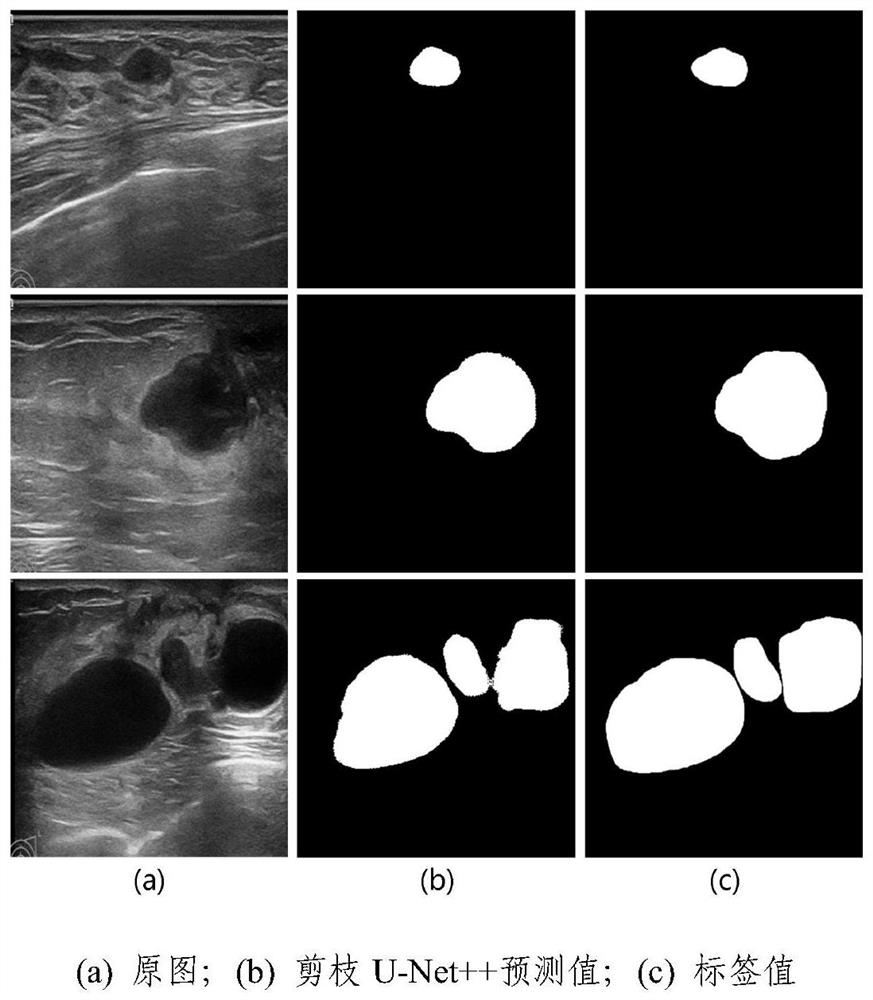 Breast lump image segmentation method and system based on pruning U-Net + +