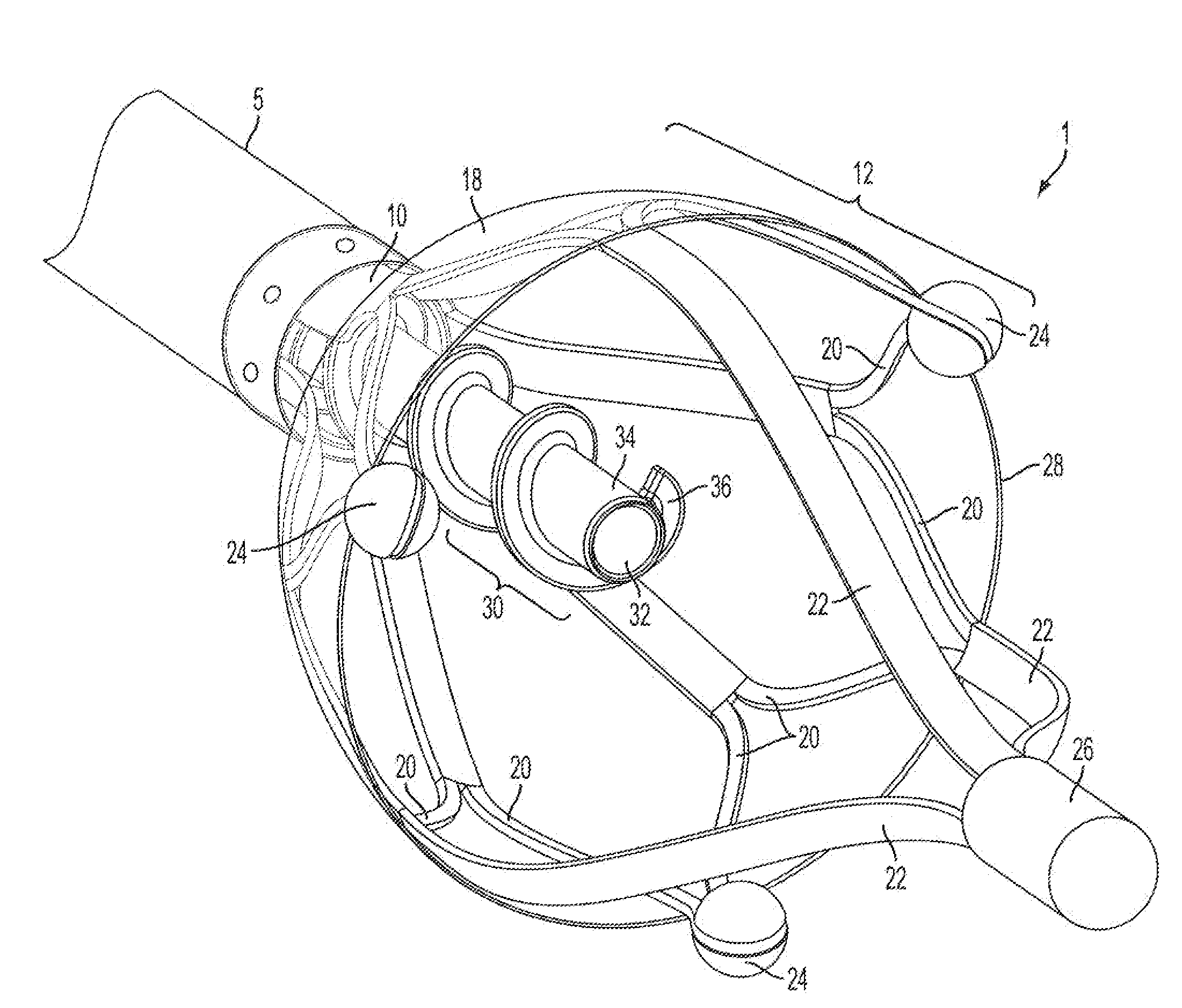 Device and method for removing material from a hollow anatomical structure