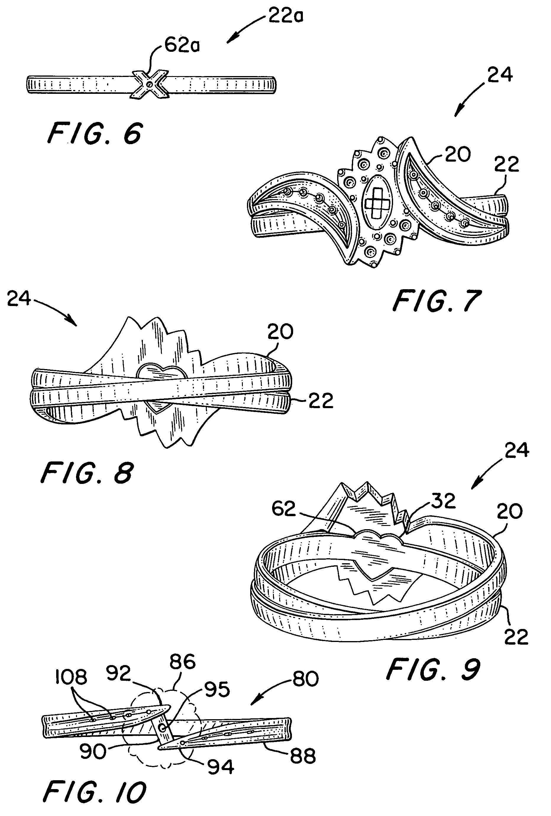 Engagement set with locking arrangement and rear crossover configuration