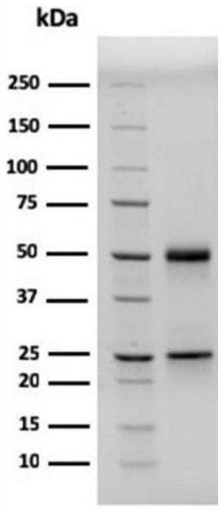 Preparation method of allergen-specific IgE antibody composite quality control product and allergen-specific IgE antibody composite quality control product