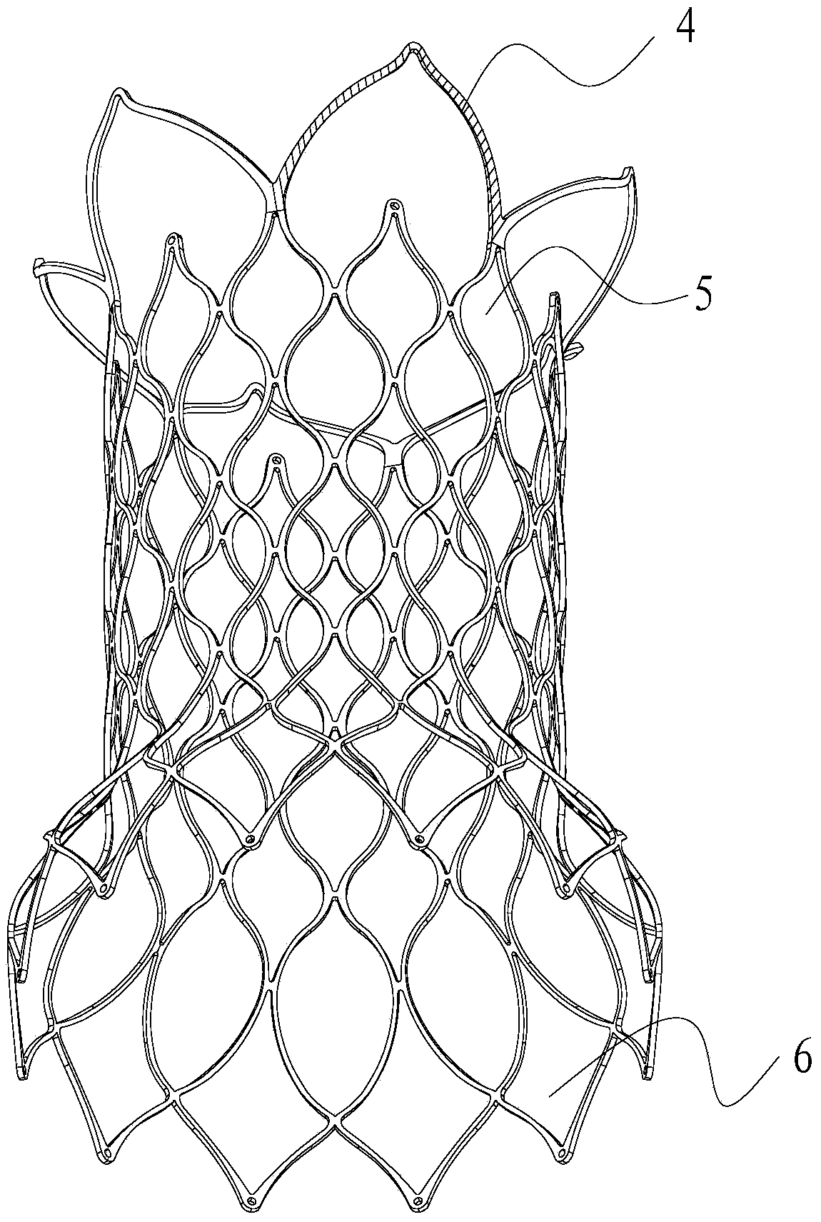 Pulmonary artery support and pulmonary artery valve replacement device with same