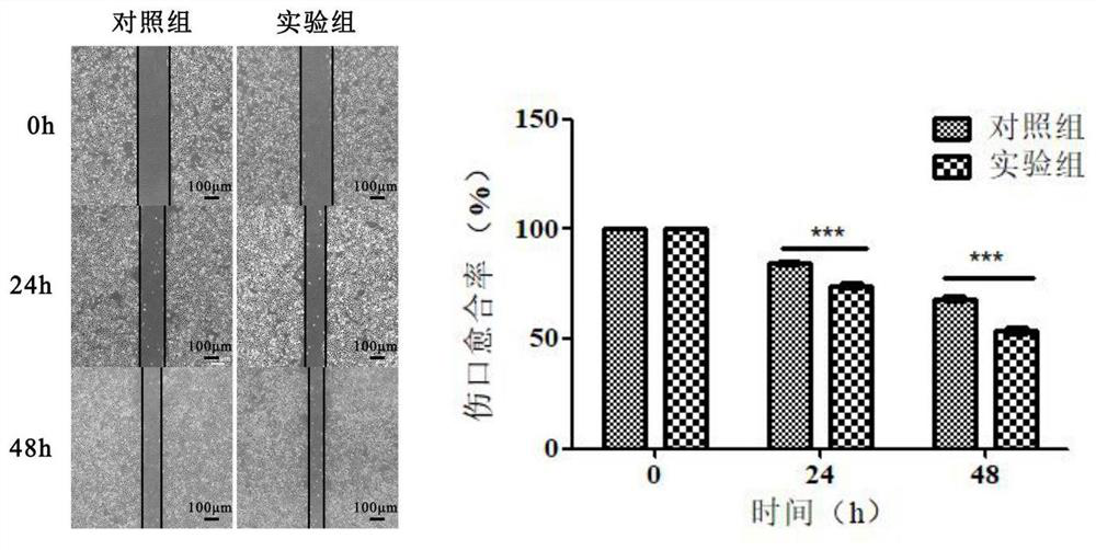 Method for detecting tumor exosome-induced cell canceration process based on atomic force microscopy