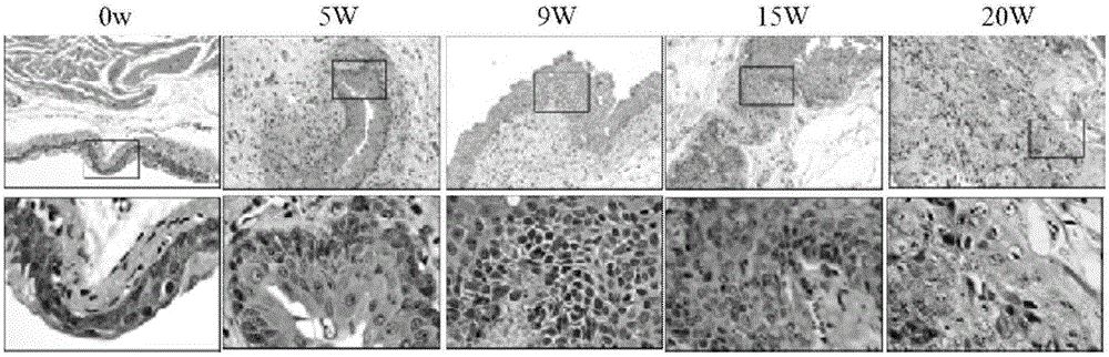 MiR-411 serving as target of bladder cancer and application of miR-411