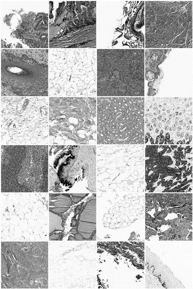 Histopathological image classification method based on convolutional neural network