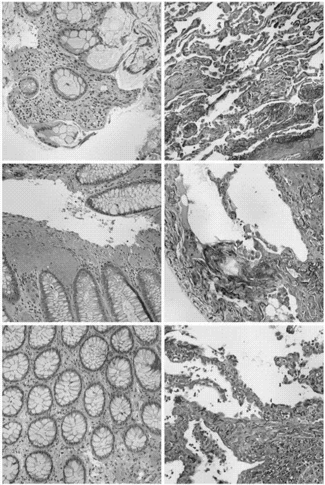 Histopathological image classification method based on convolutional neural network