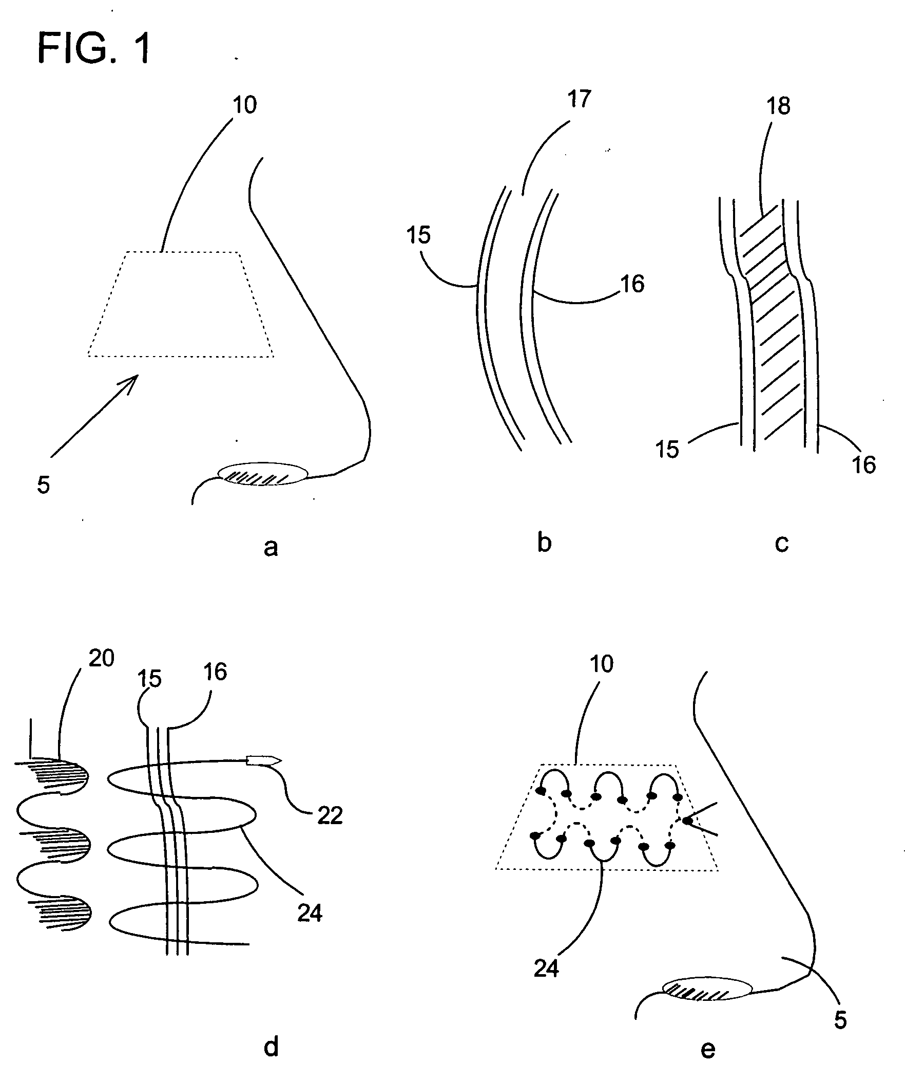 Method and apparatus for performing septal surgeries