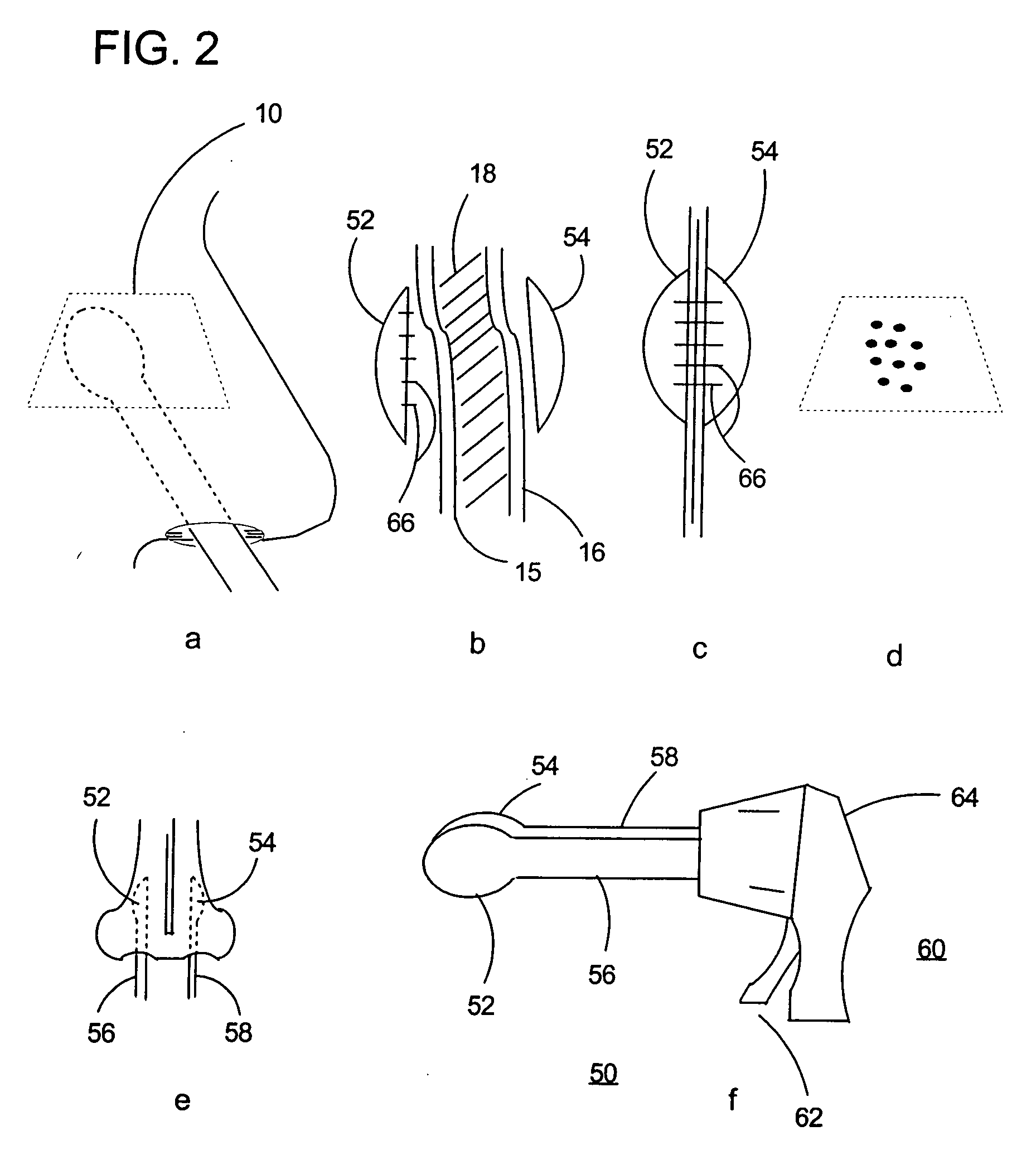 Method and apparatus for performing septal surgeries