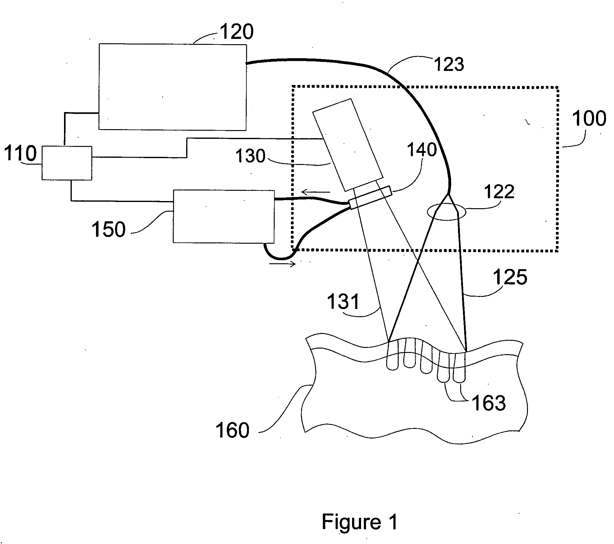 Patterned thermal treatment using patterned cryogen spray and irradiation by light