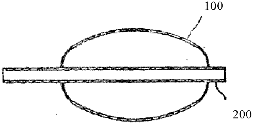 Sacculus expansion catheter for drug treatment