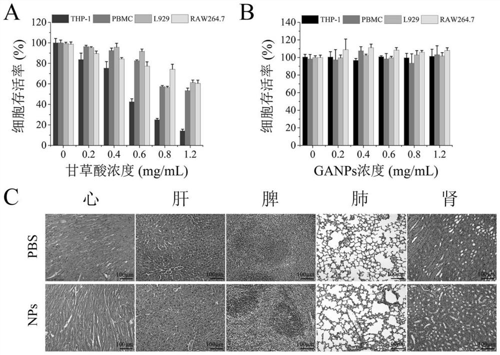 Synthesis of glycyrrhizic acid nanoparticles and combined treatment application of glycyrrhizic acid nanoparticles in novel coronavirus pneumonia