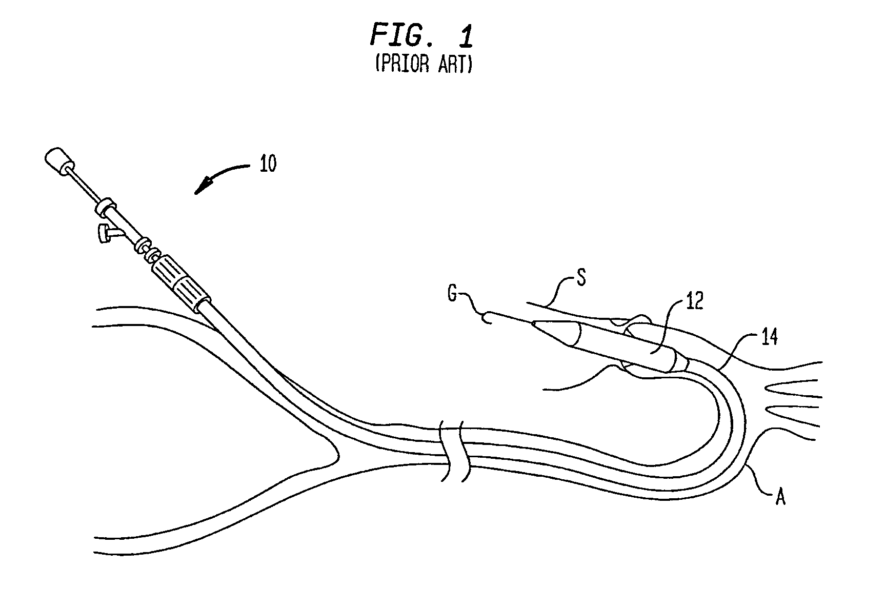 Delivery device having a curved shaft and a straightening member for transcatheter aortic valve implantation