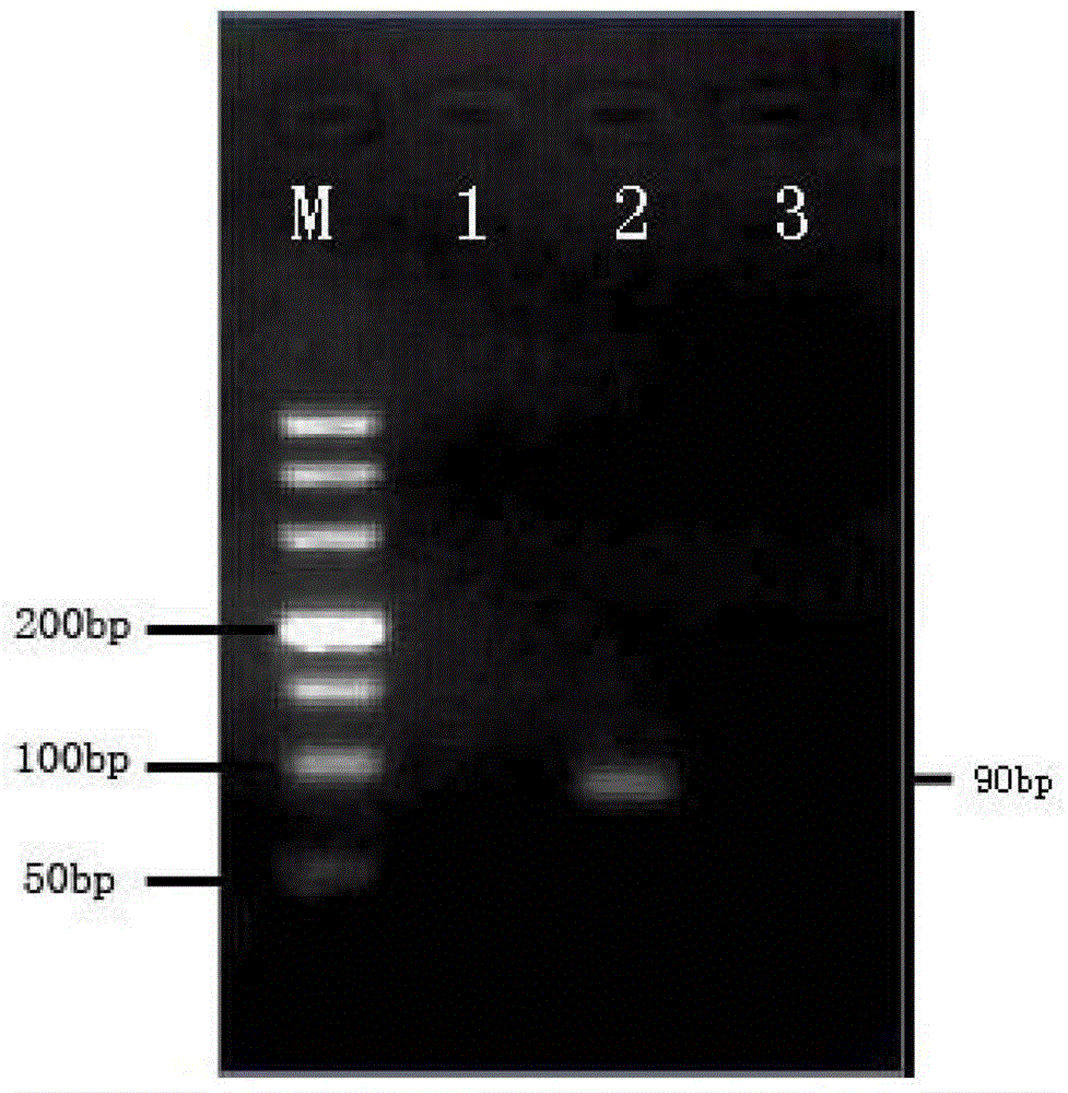 Nucleotide mts 90 and use thereof in tuberculosis diagnosis