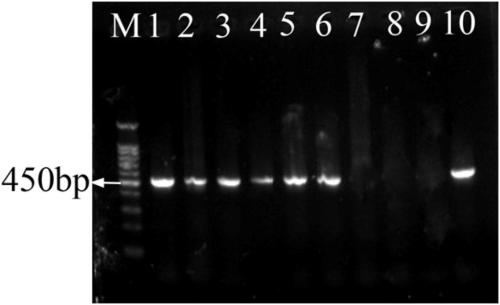 A primer and kit for early detection of intestinal microsporidia in grouper