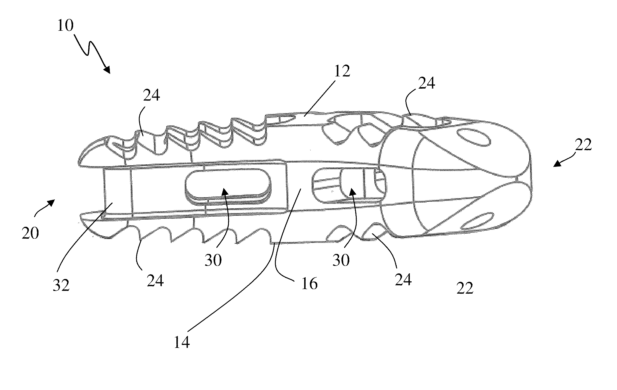 Spinal Fusion Implant and Related Methods