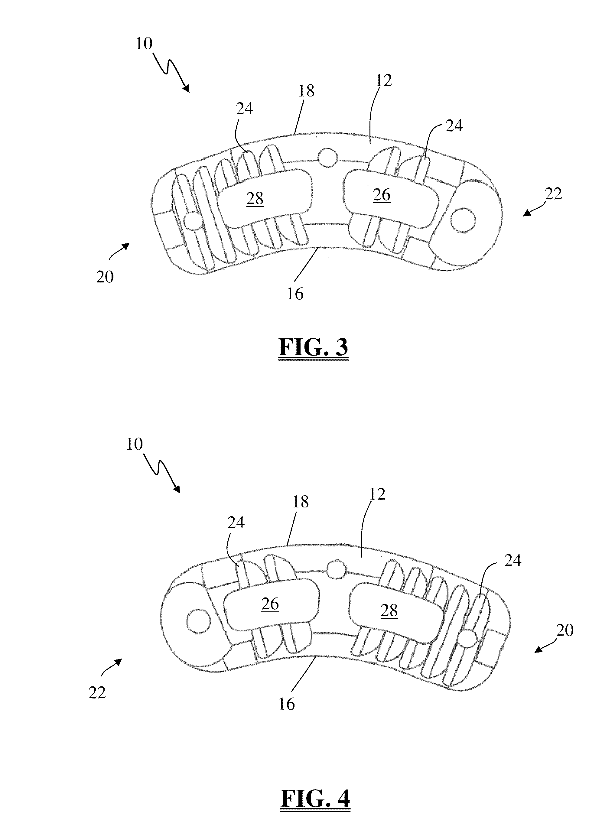 Spinal Fusion Implant and Related Methods