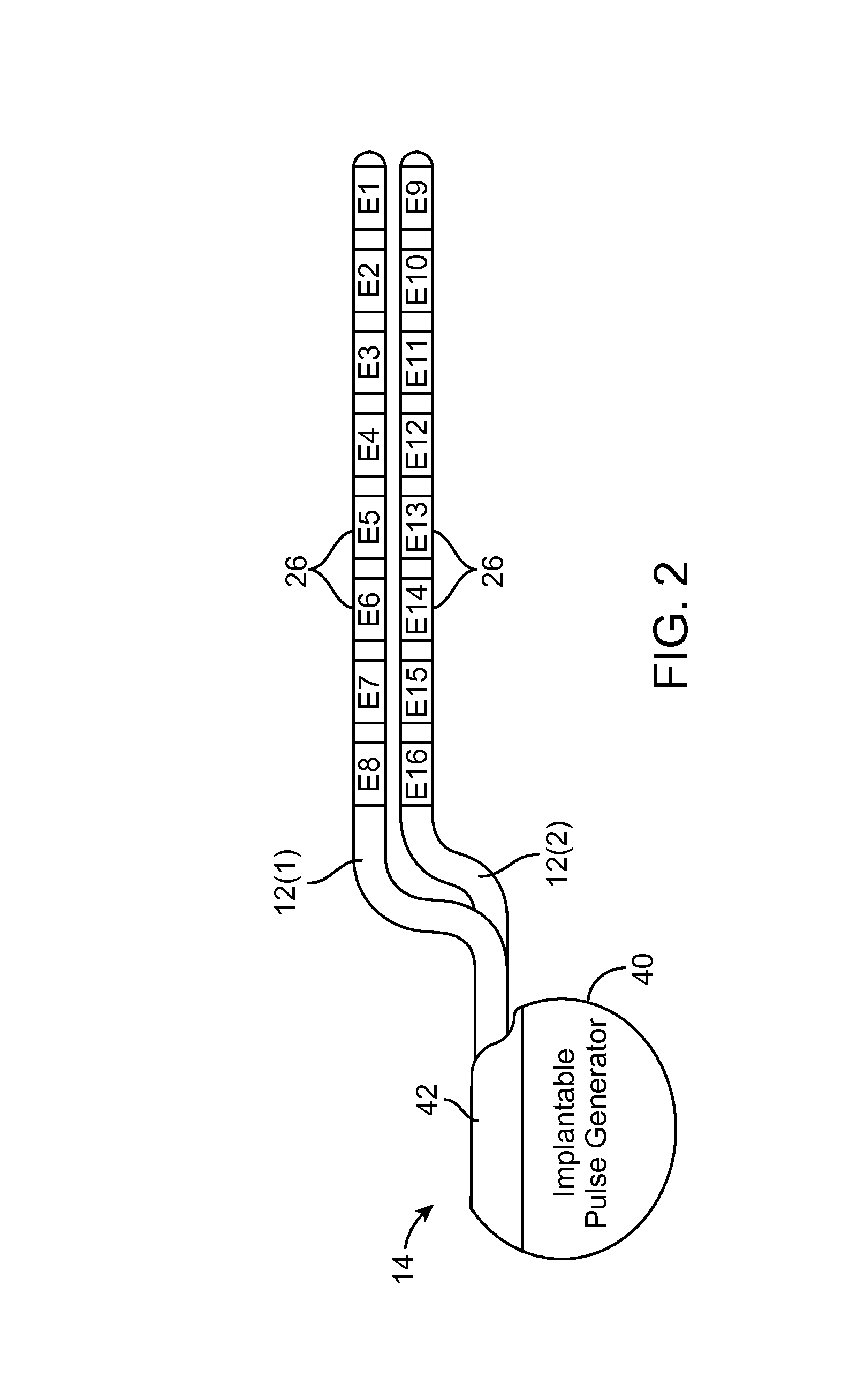 System and method for compounding low-frequency sources for high-frequency neuromodulation