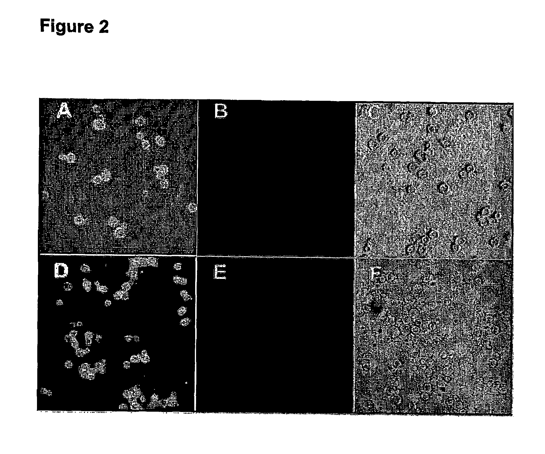 Methods for protein labeling based on acyl carrier protein