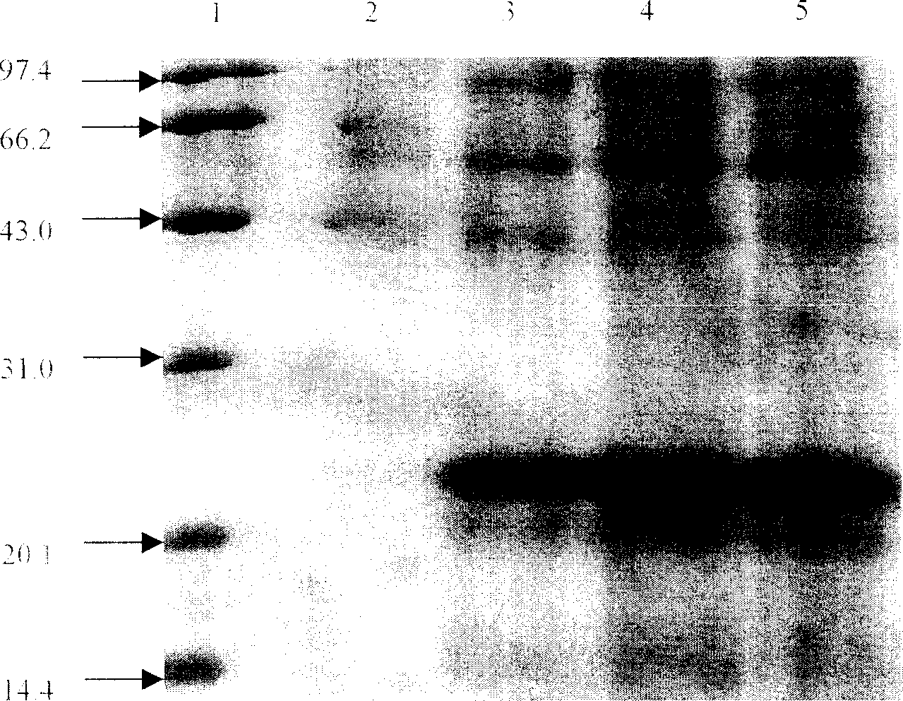 Recombinant malignant malarial parasite hypoxanthine-guanine-xanthine phosphoribosyl transferase and its preparing method and use