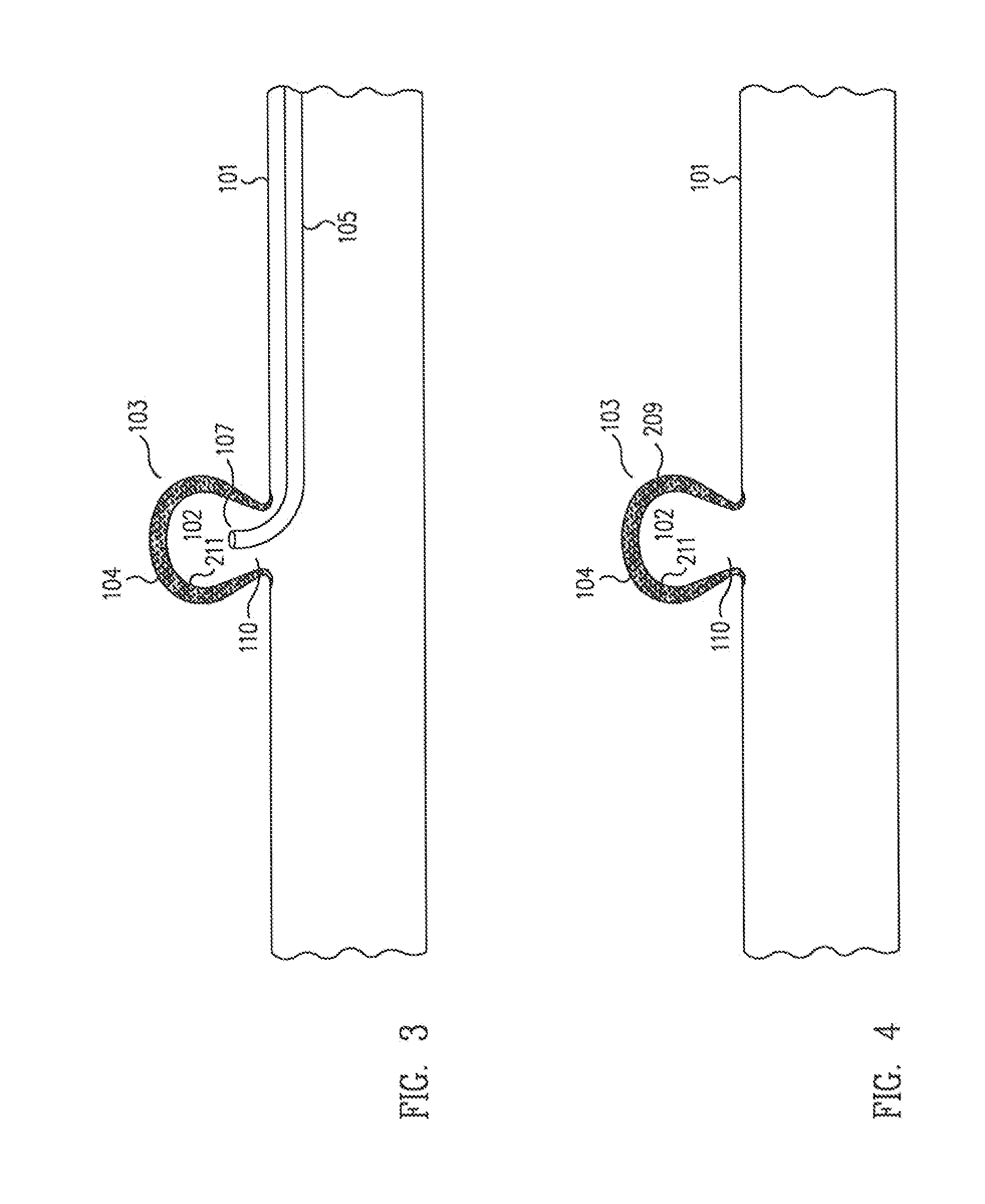 Method and apparatus for aneurismal treatment