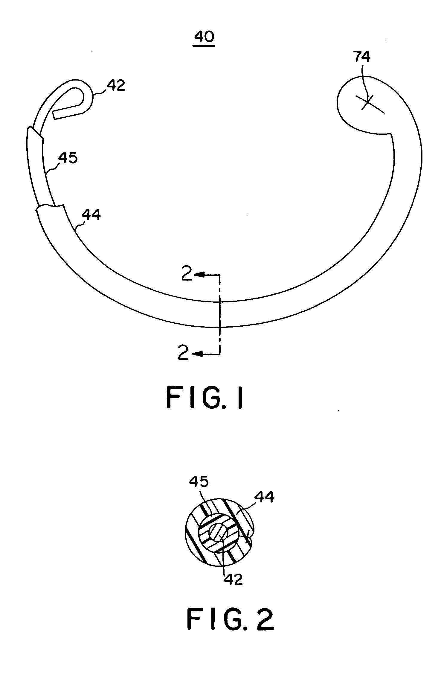 Annuloplasty band and method