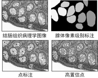 Weakly supervised gland instance segmentation method based on point labeling