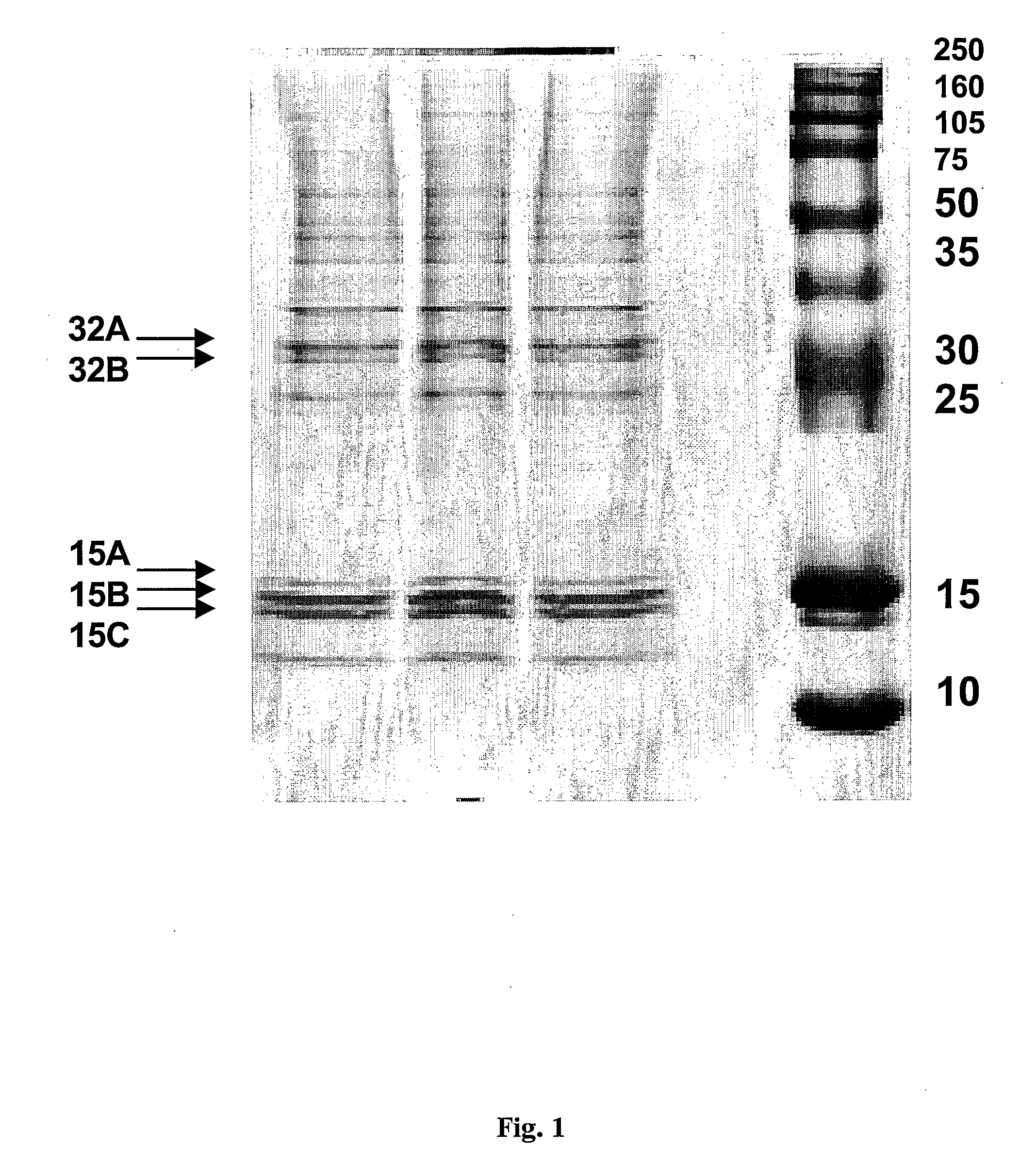 Sigma-2 Receptor, Method of Screening of Specific Ligands and Use of the Same in Diagnostic or Therapeutic Methods
